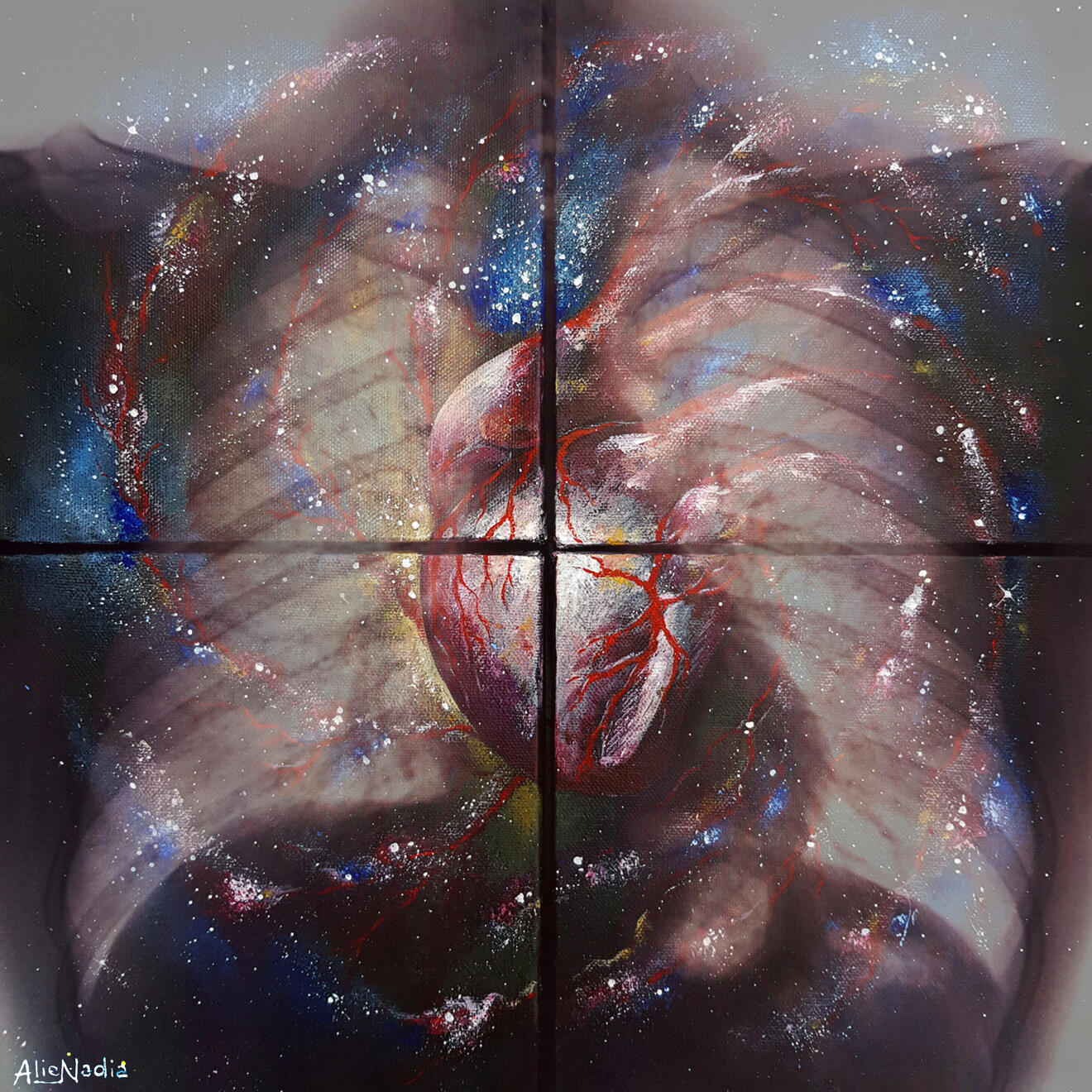 AlieNadia. Scattered krd00, krd01, krd10, krd11 Acrilico su quadrittico. Composizione digitale con lastra radiografica. 2021.